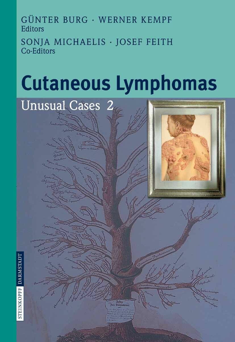 Cutaneous Lymphomas