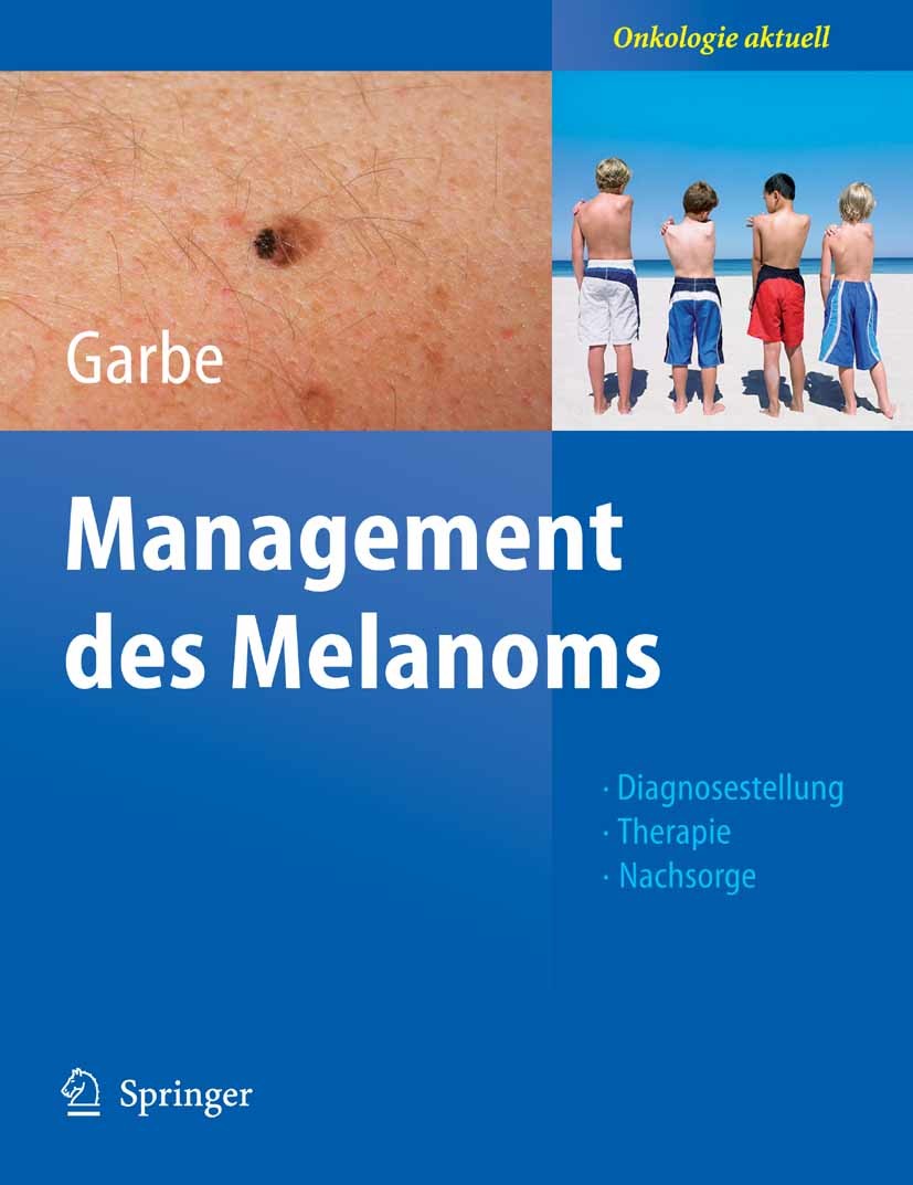 Cover Management des Melanoms