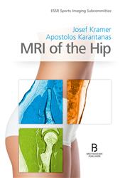 Cover MRI of the Hip