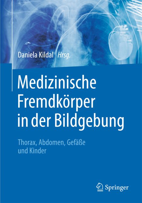 Medizinische Fremdkörper in der Bildgebung