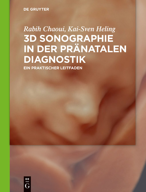 3D-Sonographie in der pränatalen Diagnostik