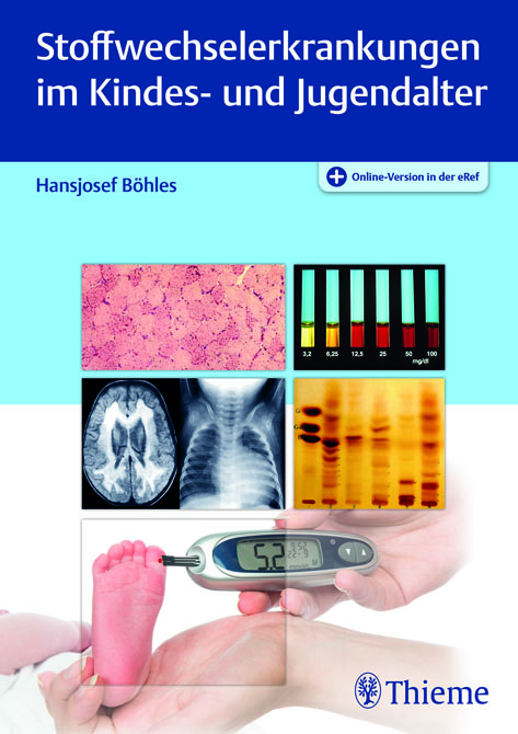 Stoffwechselerkrankungen im Kindes- und Jugendalter