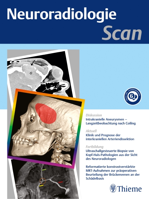 Neuroradiologie Scan