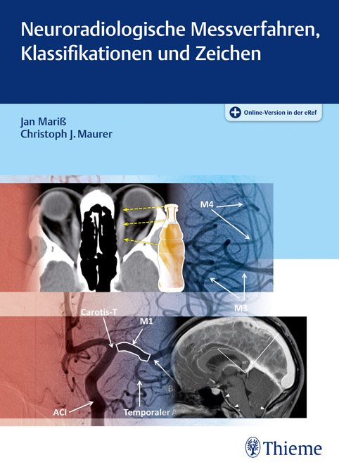 Neuroradiologische Messverfahren, Klassifikationen und Zeichen