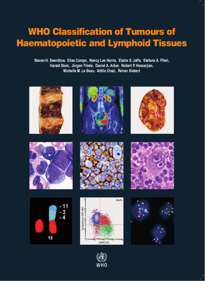 WHO Classification of Tumours of Haematopoietic and Lymphoid Tissues