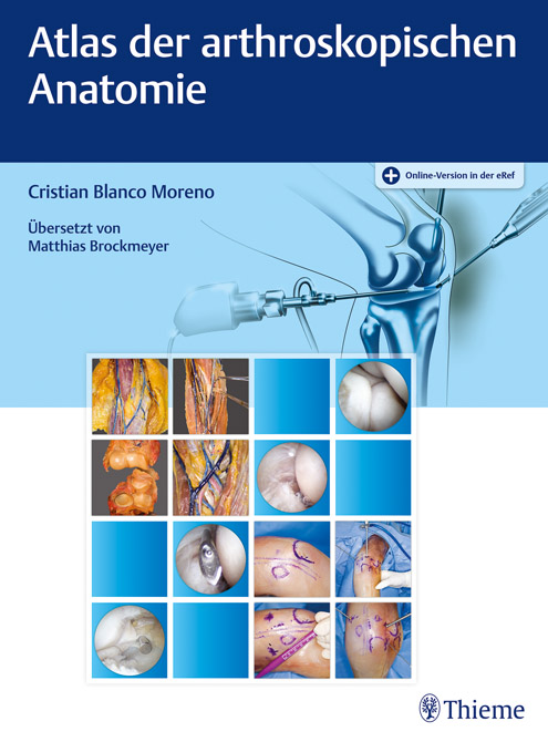 Atlas der arthroskopischen Anatomie