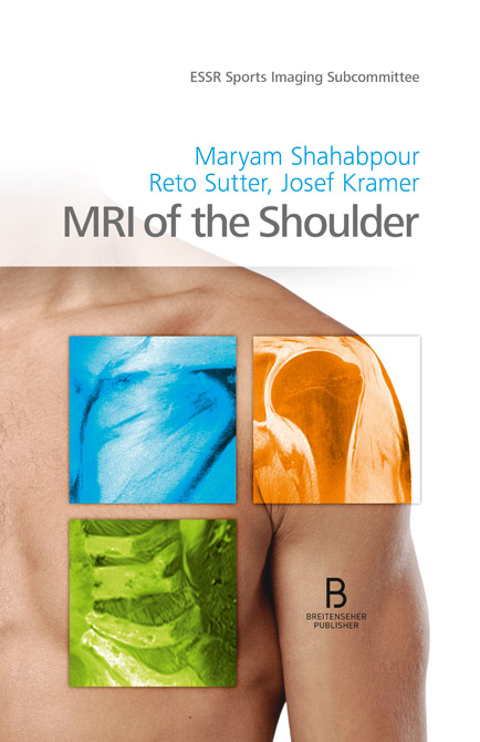 MRI of the Shoulder