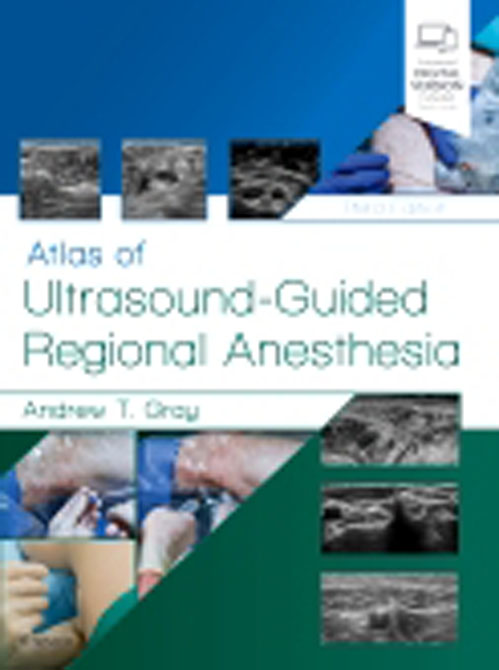 Atlas of Ultrasound-Guided Regional Anesthesia