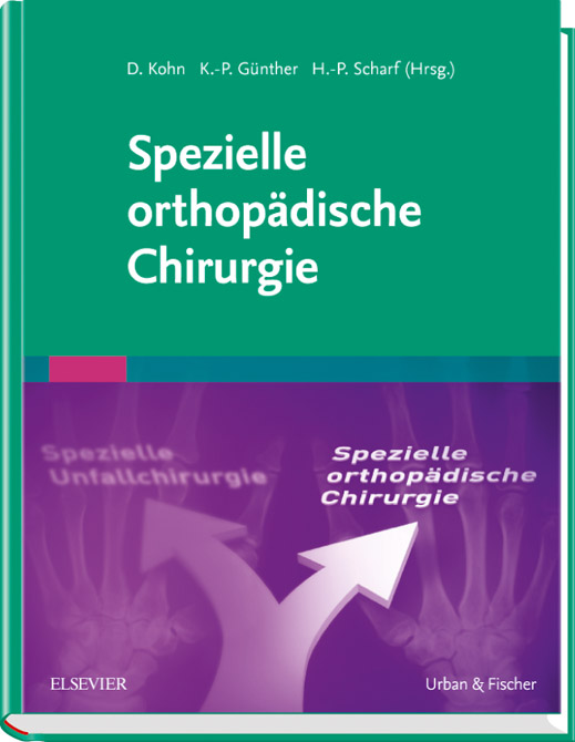 Spezielle orthopädische Chirurgie