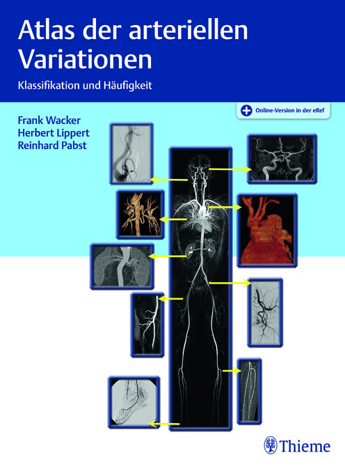 Atlas der arteriellen Variationen