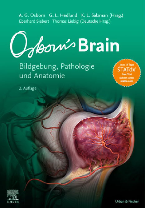 Osborn's Brain