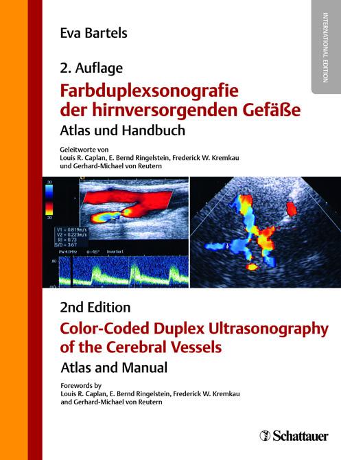 Farbduplexsonografie der hirnversorgenden Gefäße / Color-Coded Duplex Ultrasonography of the Cerebral Vessels