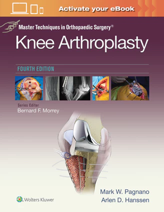 Master Techniques in Orthopedic Surgery: Knee Arthroplasty (Master Techniques in Orthopaedic Surgery)