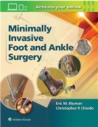 Cover Minimally Invasive Foot and Ankle Surgery