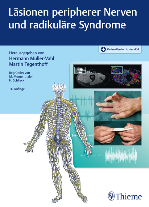 Läsionen peripherer Nerven und radikuläre Syndrome