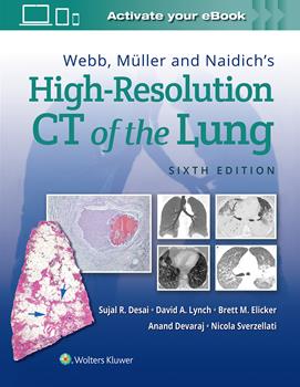 High-Resolution CT of the Lung