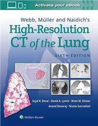 Cover High-Resolution CT of the Lung