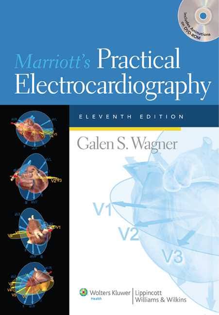 Marriotts Practical Electrocardiography