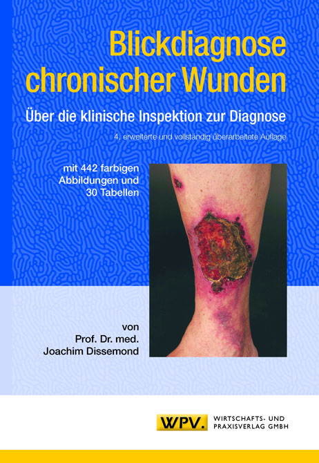 Blickdiagnose chronischer Wunden