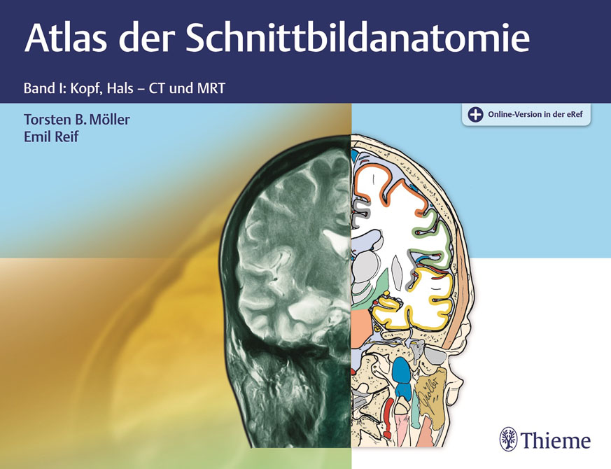 Atlas der Schnittbildanatomie Band 1