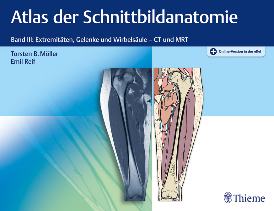 Atlas der Schnittbildanatomie Band 3