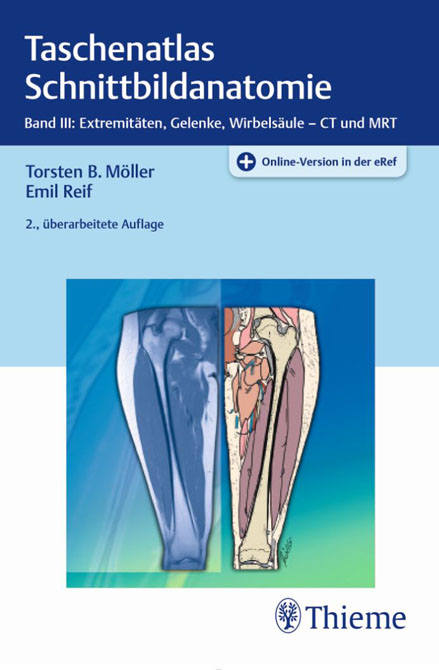 Taschenatlas Schnittbildanatomie 3