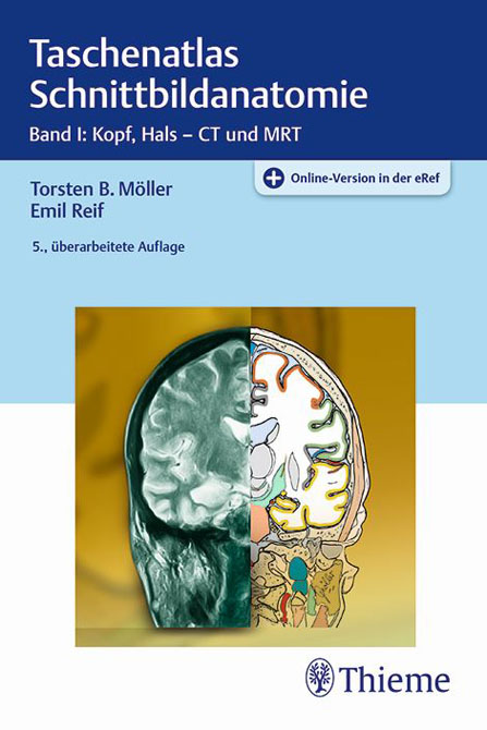 Taschenatlas Schnittbildanatomie 1