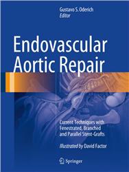 Cover Endovascular Aortic Repair