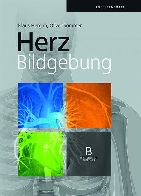 Herzbildgebung