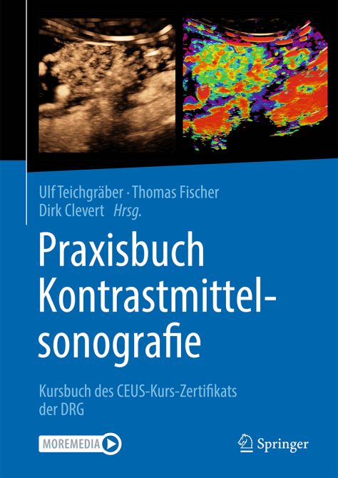 Praxisbuch Kontrastmittelsonografie