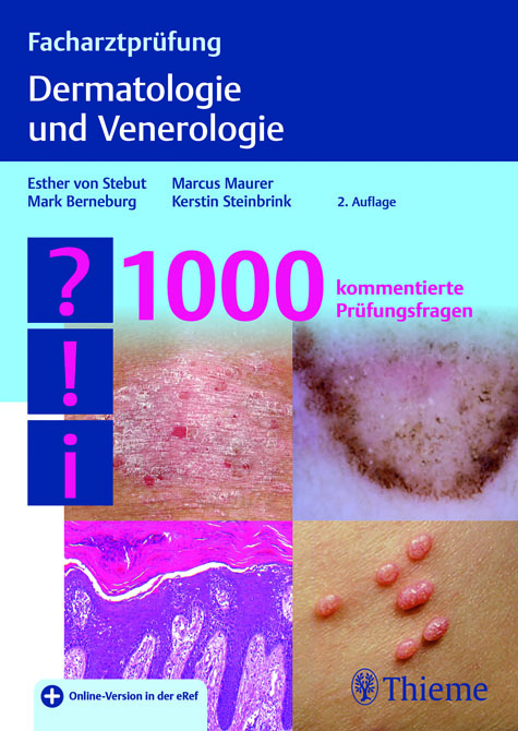Facharztprüfung Dermatologie und Venerologie - 1000 Fragen