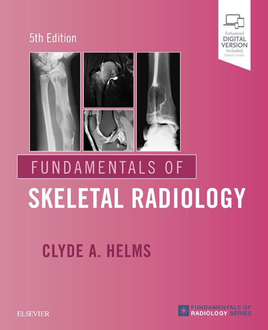 Fundamentals of Skeletal Radiology