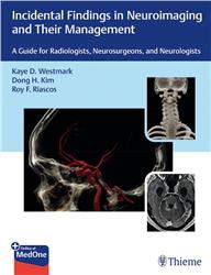Cover Incidental Findings in Neuroimaging and Their Management