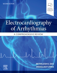 Electrocardiography of Arrhythmias: A Comprehensive Review