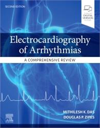 Cover Electrocardiography of Arrhythmias: A Comprehensive Review