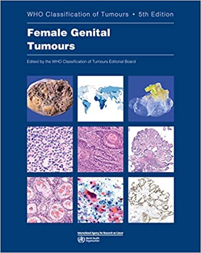 WHO Classification of Tumours. Female Genital Tumours -