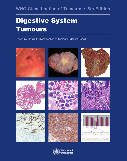 WHO Classification of Tumours: Digestive System Tumours