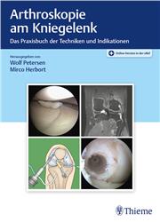 Cover Arthroskopie am Kniegelenk