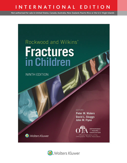 Rockwood and Wilkins' Fractures in Children
