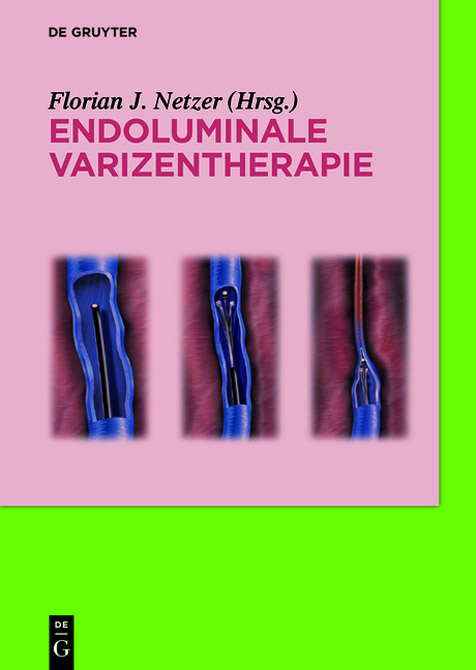 Endoluminale Varizentherapie