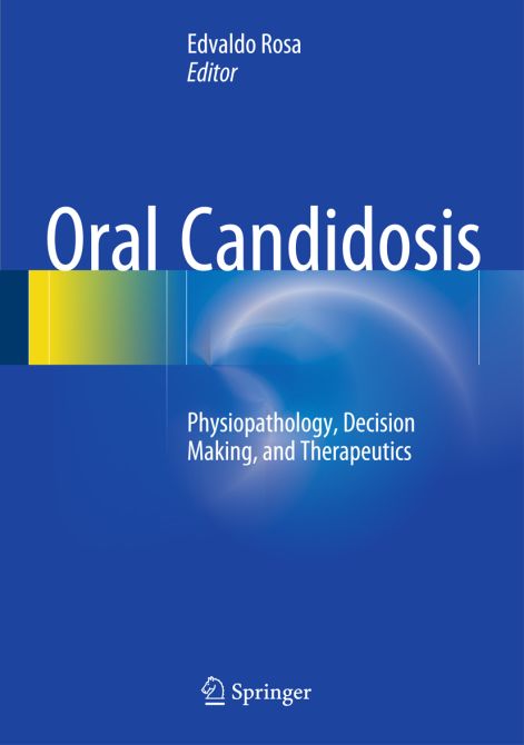 Oral Candidosis