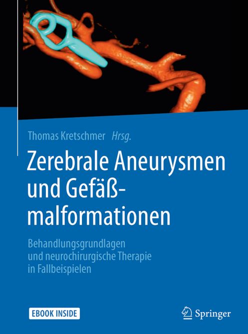 Zerebrale Aneurysmen und Gefäßmalformationen