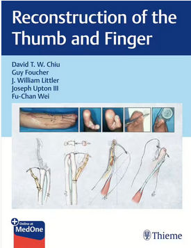 An Atlas of Digit Reconstruction