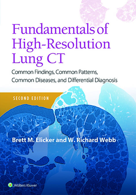 Fundamentals of High-Resolution Lung CT