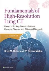 Cover Fundamentals of High-Resolution Lung CT