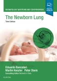 Neonatology Questions and Controversies