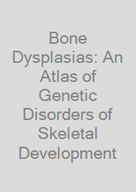 Bone Dysplasias: An Atlas of Genetic Disorders of Skeletal Development