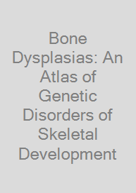 Cover Bone Dysplasias: An Atlas of Genetic Disorders of Skeletal Development