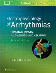 Cover Electrophysiology of Arrhythmias