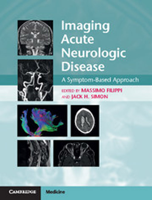 Imaging Acute Neurologic Disease